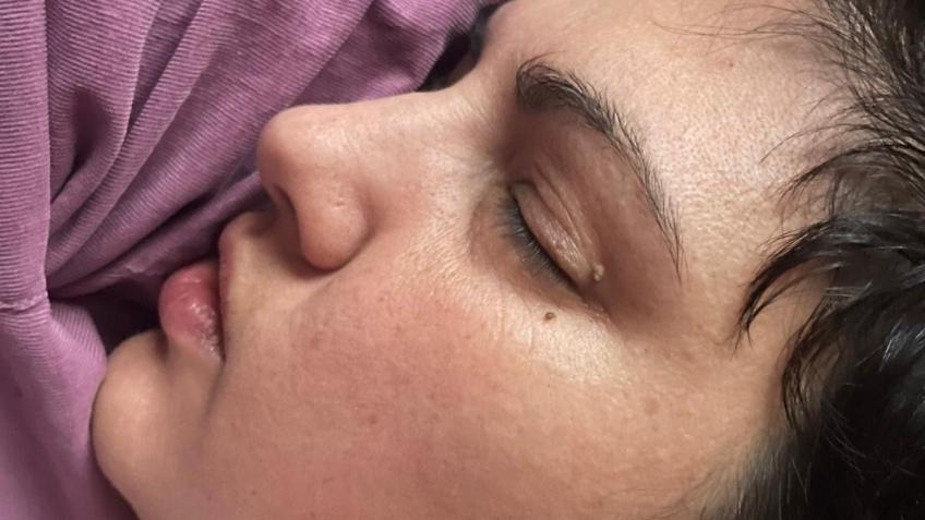Help Roma recover after major spinal surgery