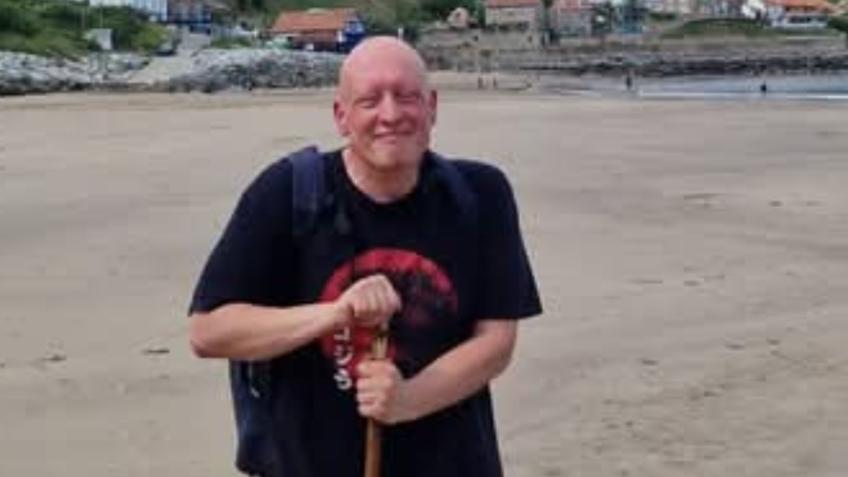Jim BDS Parkinson's surgery