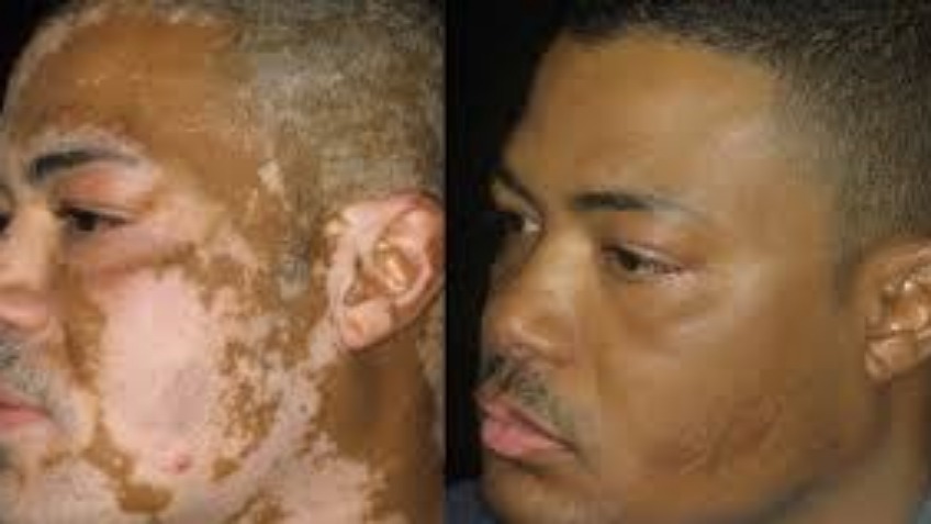 medical tattooing - camoconfidence