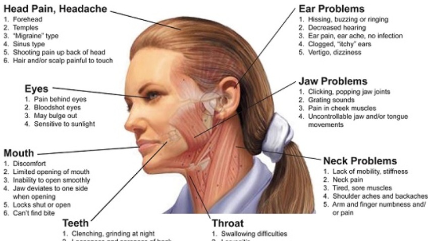 The Jaw Support