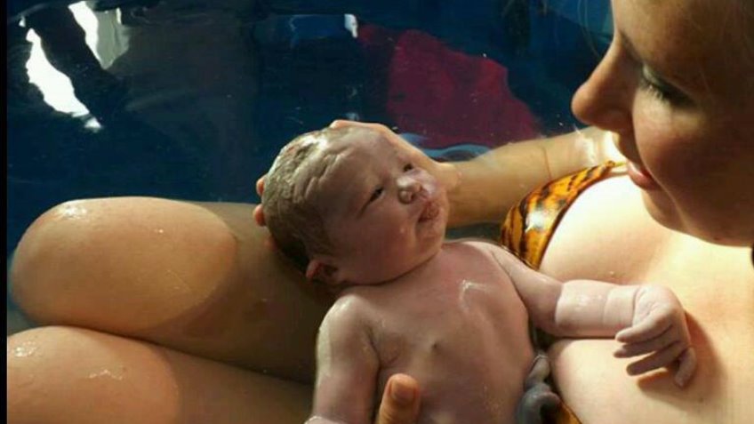 Optimal Cord Clamping/#waitforwhite campaign