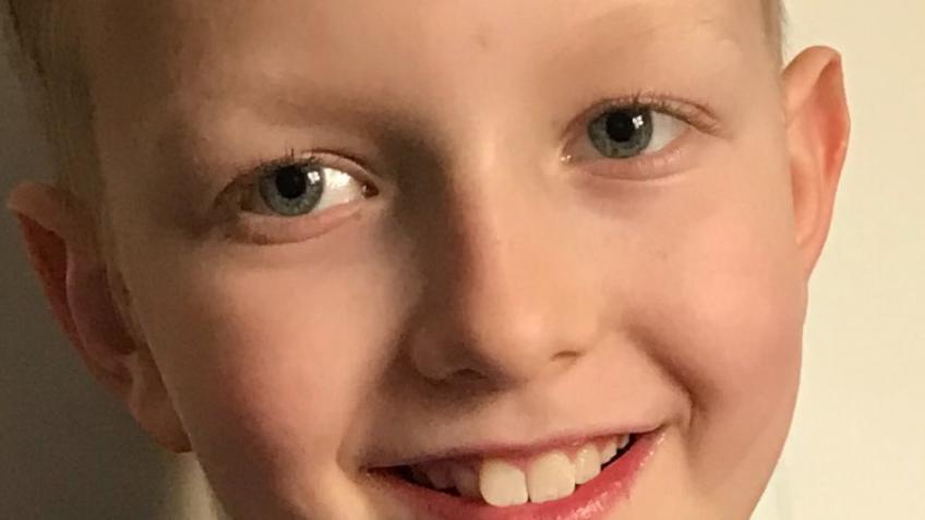 NHS Front line hair shave will shave all head hair