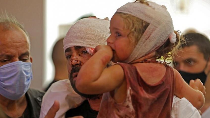 Healing Beirut's Children